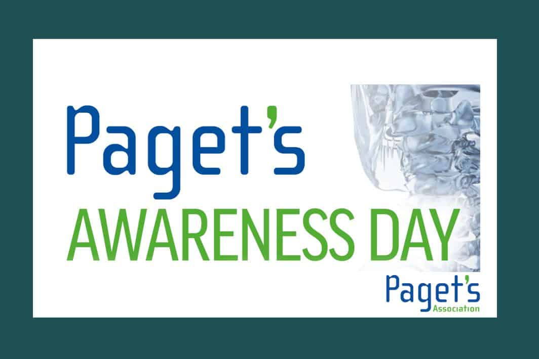 Paget’s Awareness Day - Impact on Individuals and Communities