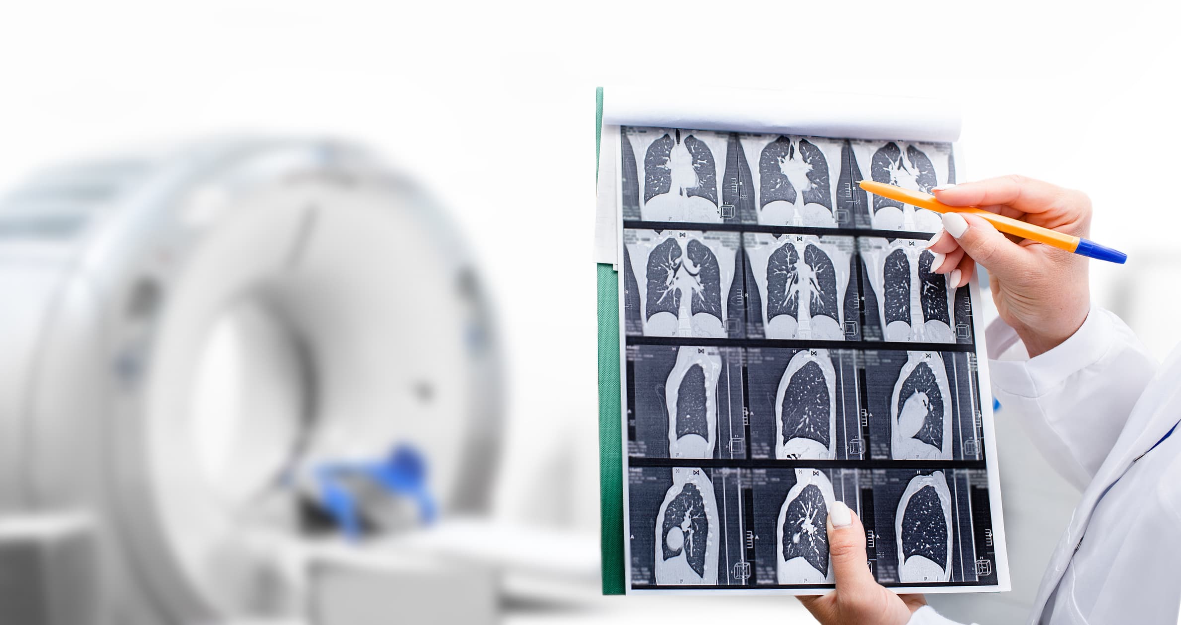 lung cancer awareness
