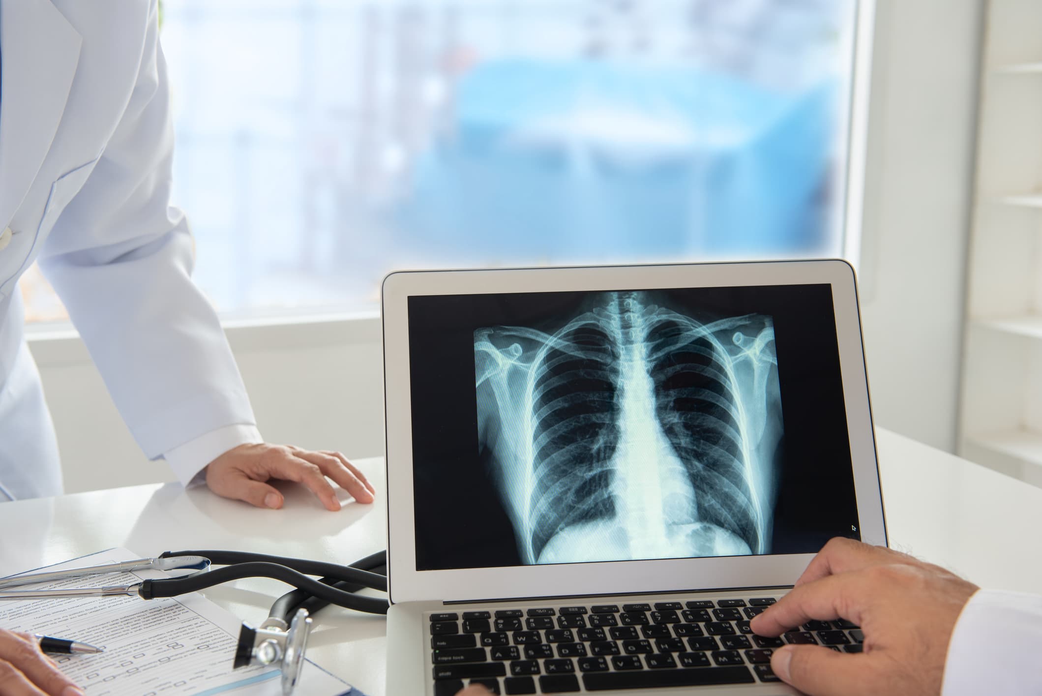 Awareness Days – Lung Cancer Awareness Month