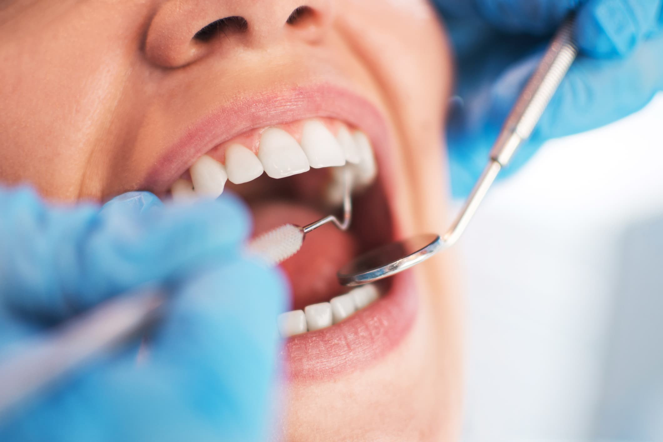 Awareness Days – Mouth Cancer Action Month