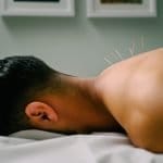 Acupuncture Awareness Week 2026