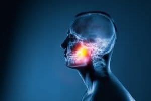 Trigeminal Neuralgia Awareness Day USA 2026