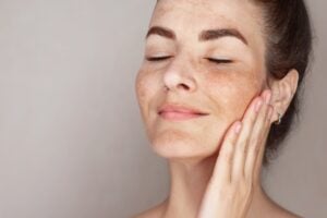 International Skin Pigmentation Day 2026