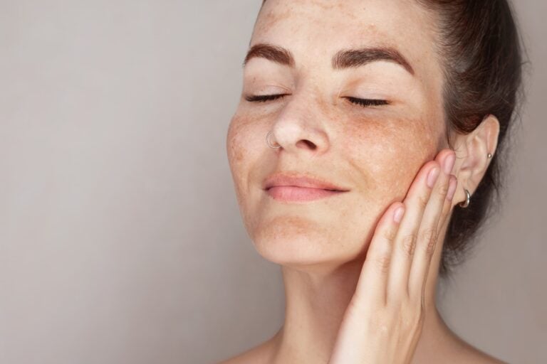 International Skin Pigmentation Day 2026