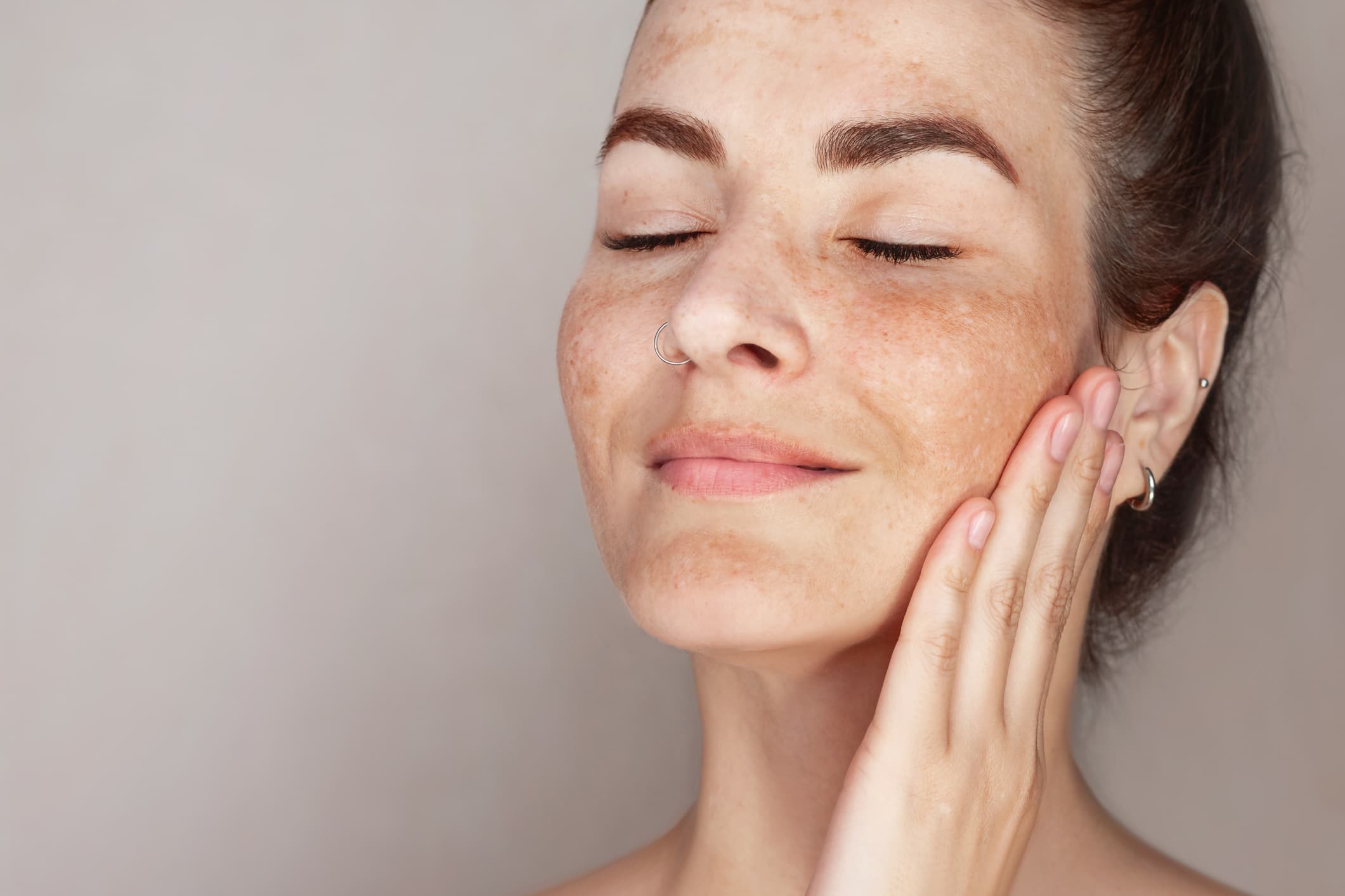 International Skin Pigmentation Day