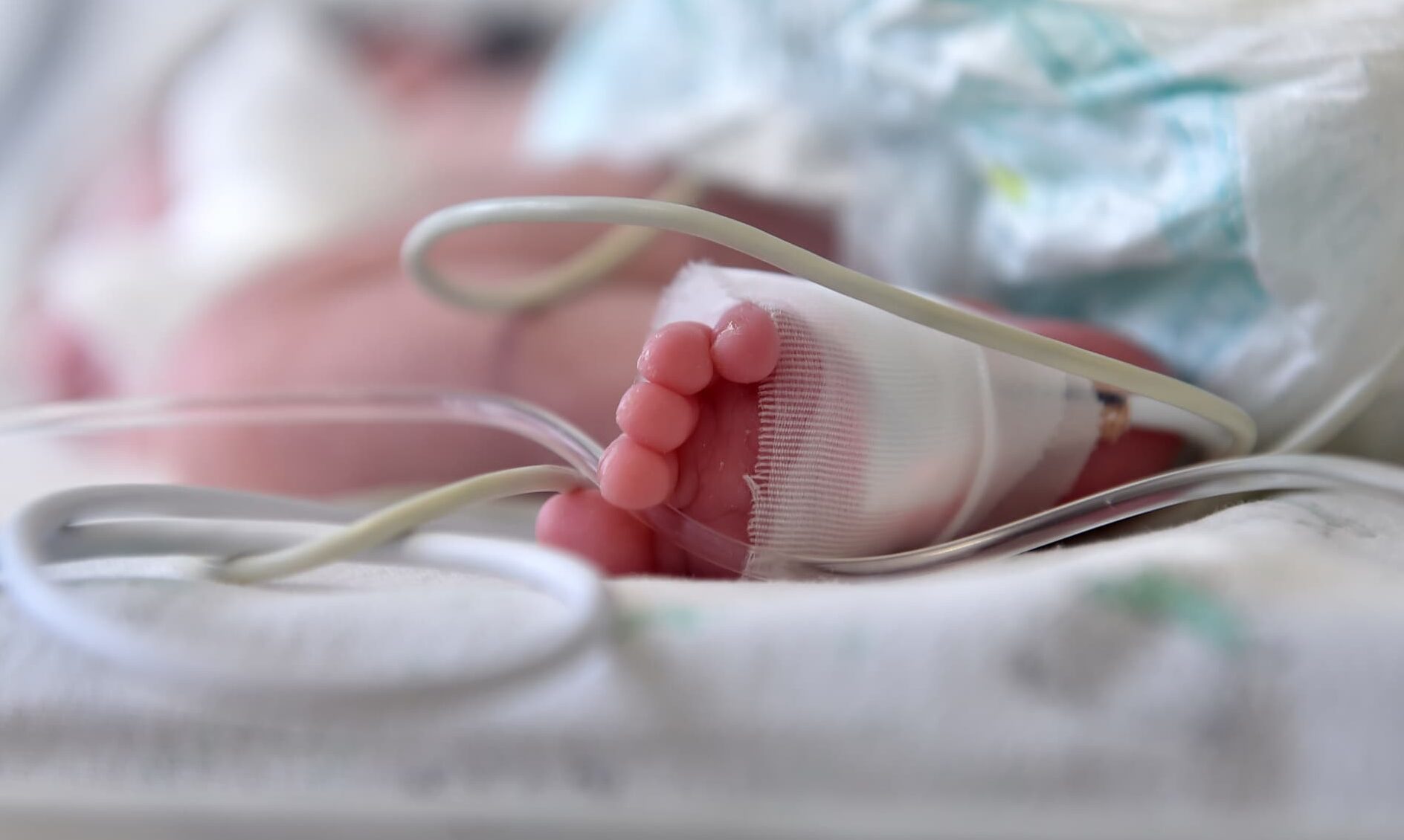 World Prematurity Day 2025