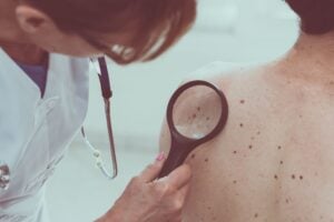 Melanoma Monday