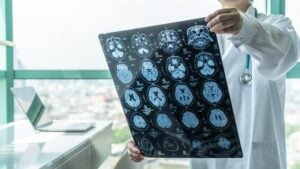Action For Brain Injury Awareness Week 2026