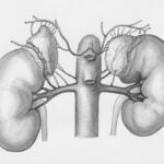 World Kidney Day 2026