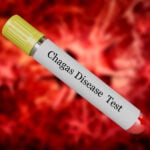World Chagas Disease Day