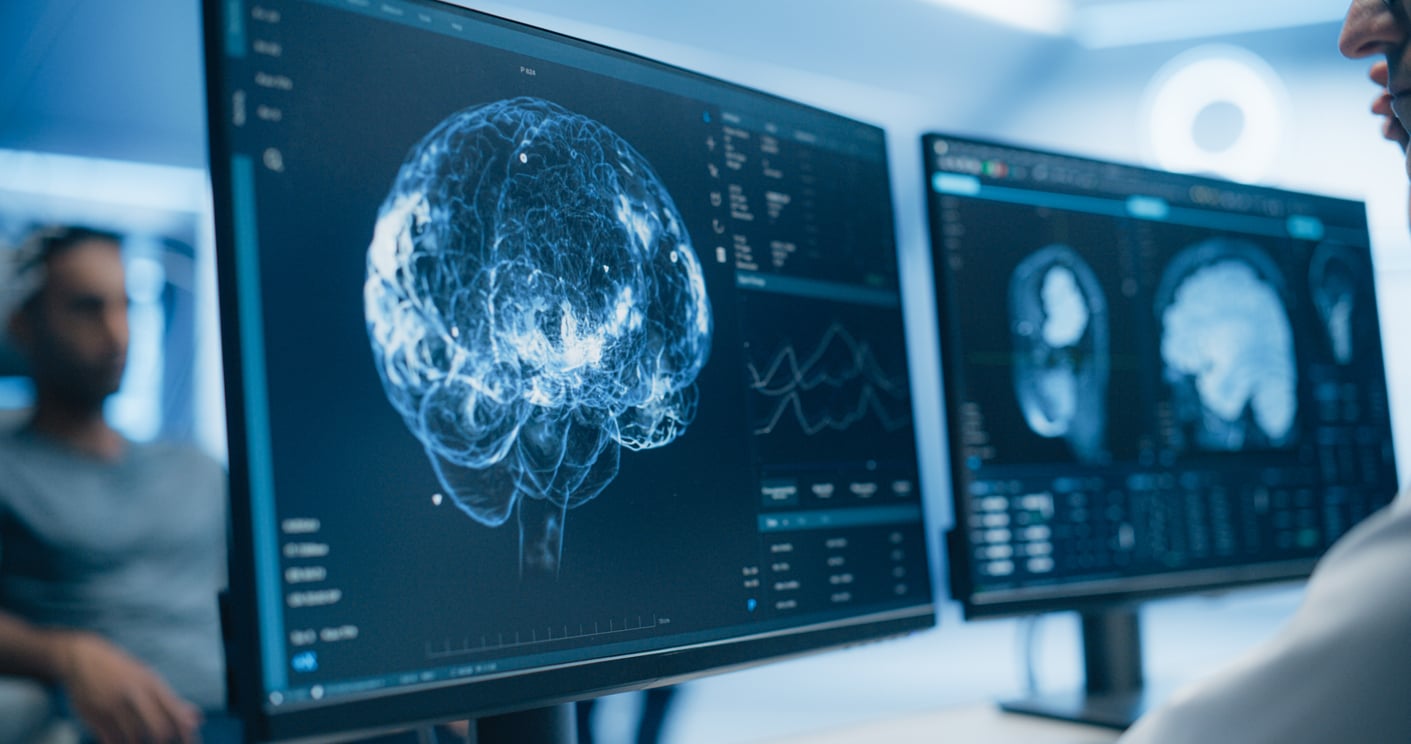 Cavernoma Awareness Day brain scan