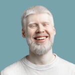 International Albinism Awareness Day