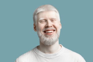 International Albinism Awareness Day