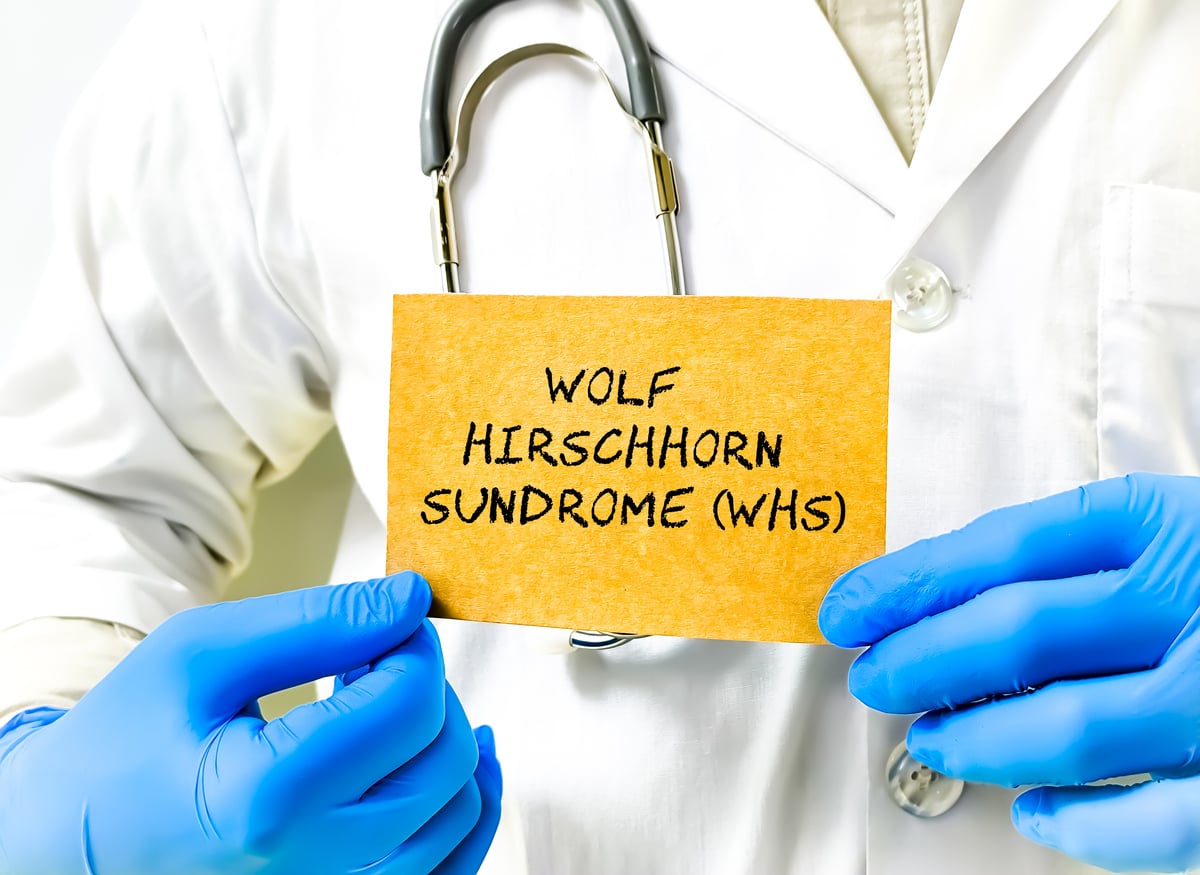 Child with rare genetic syndrome representing KBG Syndrome Awareness Day