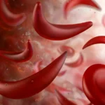National Sickle Cell Awareness Month