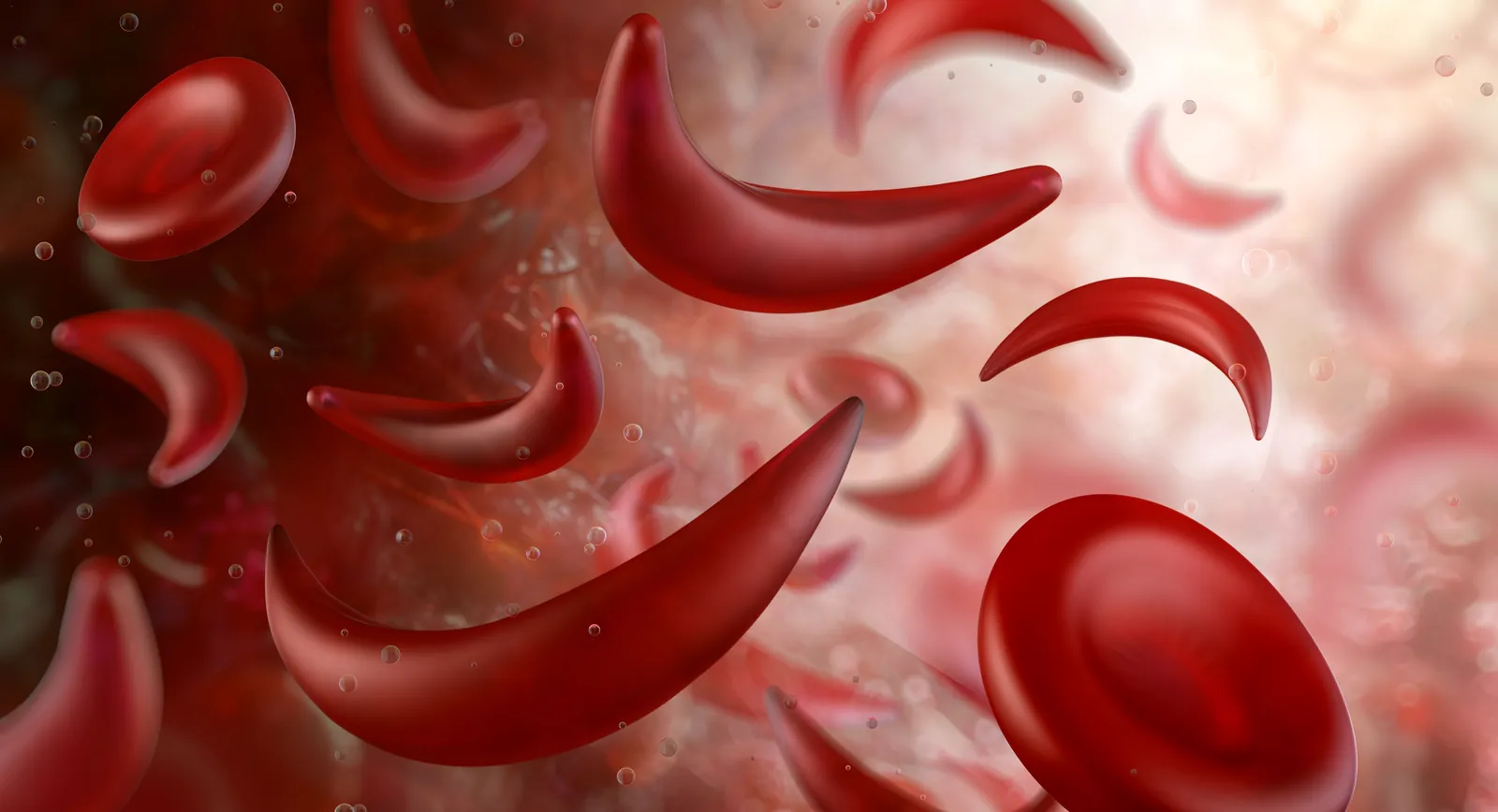 National Sickle Cell Awareness Month: illustration of sickle-shaped red blood cells