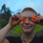 Alopecia Areata Awareness Month
