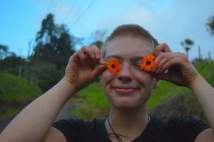 Alopecia Areata Awareness Month