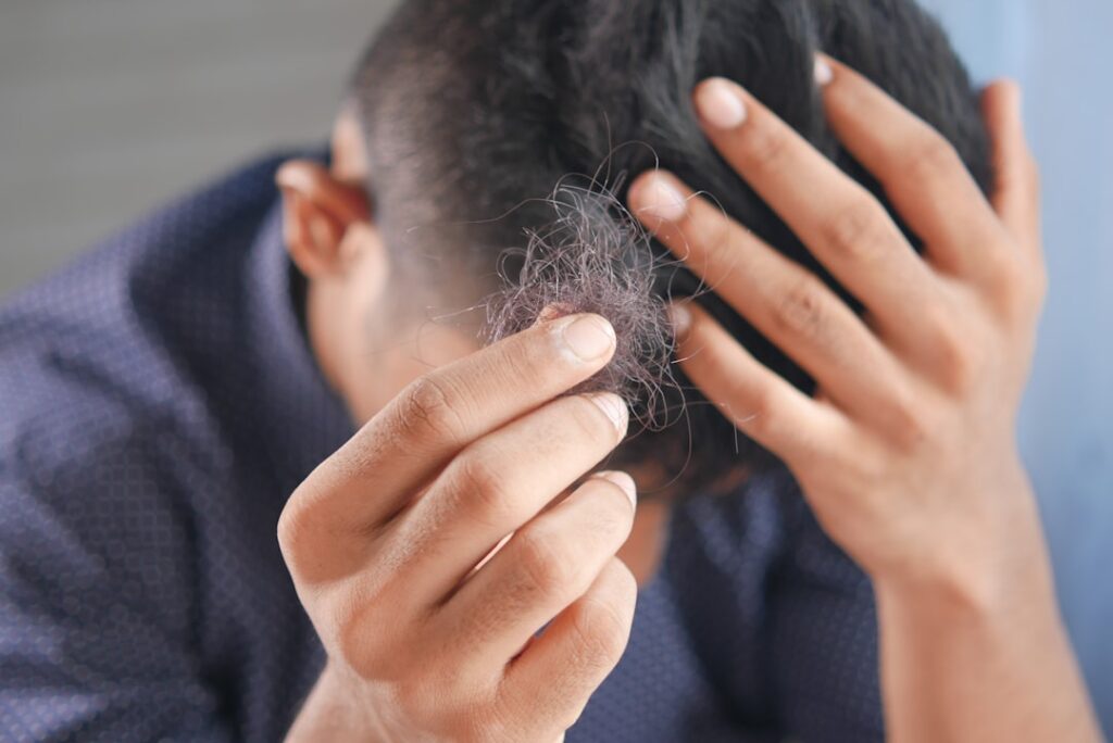 National Hair Loss Awareness Month