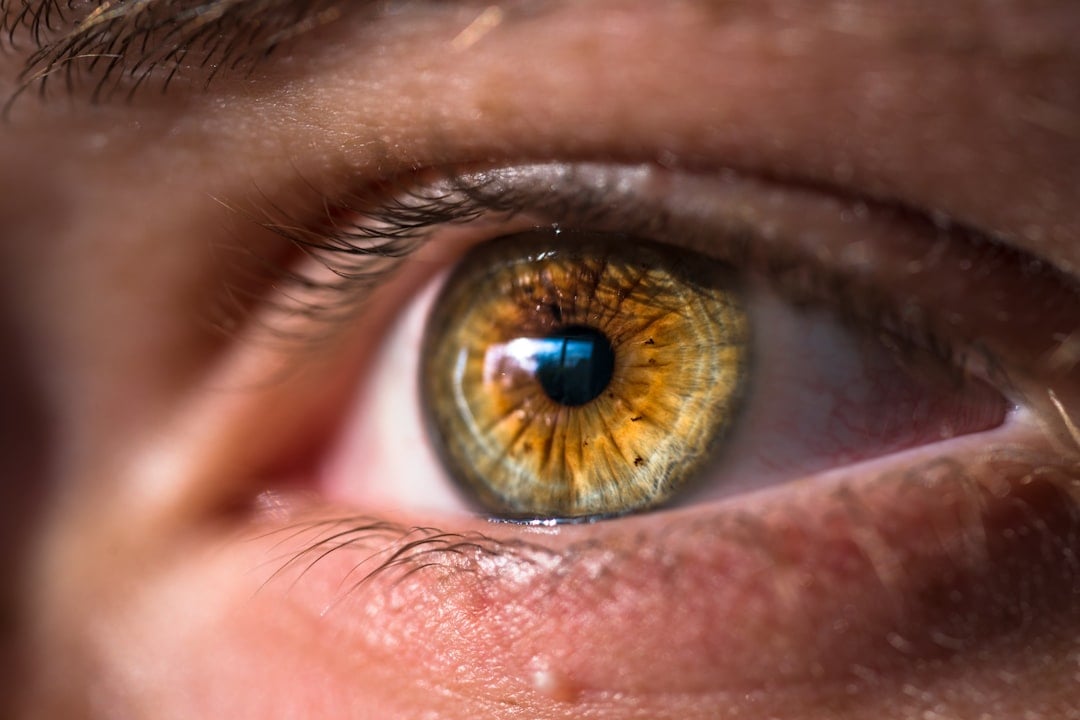 National Different Colored Eyes Day — different colored eyes