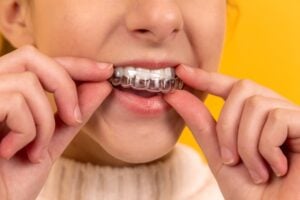 National Align Your Teeth Day